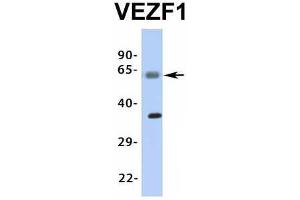 Image no. 8 for anti-Vascular Endothelial Zinc Finger 1 (VEZF1) (Middle Region) antibody (ABIN2776482)