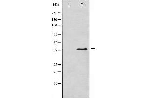 Image no. 11 for anti-Eukaryotic Translation Initiation Factor 2A, 65kDa (EIF2A) (pSer51) antibody (ABIN6255389)