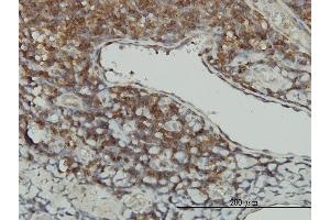 Image no. 1 for anti-serine/threonine Kinase 16 (STK16) (AA 1-305) antibody (ABIN563708)