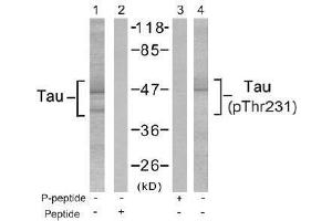 Image no. 2 for anti-Microtubule-Associated Protein tau (MAPT) (Thr231) antibody (ABIN197266)