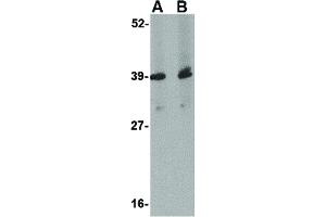 Image no. 1 for anti-Amyloid beta (A4) Precursor Protein-Binding, Family A, Member 1 (APBA1) (Internal Region) antibody (ABIN6657697)
