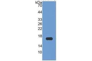 Image no. 1 for Apolipoprotein A-I (APOA1) ELISA Kit (ABIN6574163)