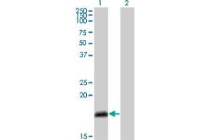 Image no. 1 for anti-Numb Homolog (NUMB) (AA 1-135) antibody (ABIN563731)
