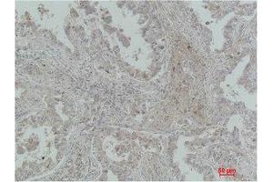 Image no. 2 for anti-Mitochondrial Calcium Uptake 1 (MICU1) antibody (ABIN3181571)