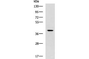 Western blot analysis of Mouse small intestines tissue lysate using TDP2 Polyclonal Antibody at dilution of 1:600
