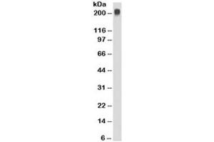 Image no. 2 for anti-Temporarily Assigned Gene Name Family Member (TAG-72) antibody (ABIN3026071)