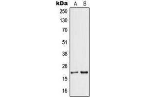 Image no. 1 for anti-Secretogranin V (7B2 Protein) (SCG5) (Center) antibody (ABIN2707015)