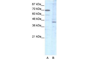 Image no. 2 for anti-LIM Homeobox 2 (LHX2) (Middle Region) antibody (ABIN2792632)