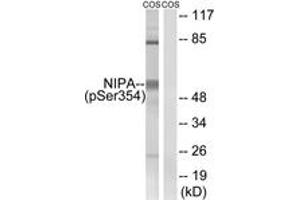 Western blot analysis of extracts from COS7 cells treated with HU 2nM 24h, using NIPA (Phospho-Ser354) Antibody.