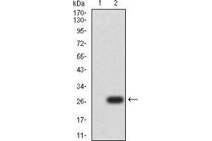 Image no. 2 for anti-Uncoupling Protein 3 (Mitochondrial, Proton Carrier) (UCP3) (AA 1-113) antibody (ABIN5542343)