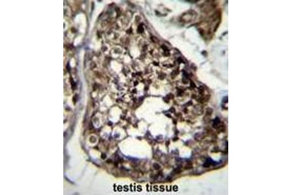 TBCEL 抗体  (C-Term)