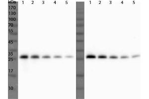 Image no. 2 for anti-ULP1 (ULP1) antibody (ABIN129522)