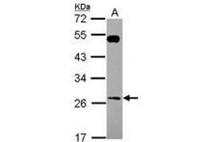 Image no. 1 for anti-RAB26, Member RAS Oncogene Family (RAB26) (AA 53-238) antibody (ABIN1500556)