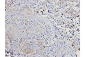 IHC-P Image Immunohistochemical analysis of paraffin-embedded Cal27 xenograft, using ARAF, antibody at 1:500 dilution.