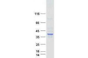 Image no. 1 for serine Dehydratase (SDS) protein (Myc-DYKDDDDK Tag) (ABIN2731550)