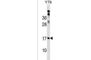 GR1 Antibody (N-term) 18154a western blot analysis in Y79 cell line lysates (35 μg/lane).