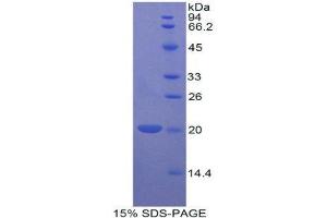 Image no. 1 for BCL2-Like 2 (BCL2L2) (AA 11-171) protein (His tag) (ABIN1877347)