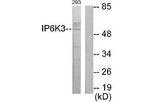 Image no. 1 for anti-Inositol Hexakisphosphate Kinase 3 (IP6K3) (AA 201-250) antibody (ABIN1534075)