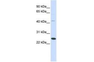 Image no. 1 for anti-Family With Sequence Similarity 119A (FAM119A) (AA 72-121) antibody (ABIN6741188)