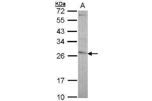 WB Image Sample (30 ug of whole cell lysate) A: A431 , 12% SDS PAGE antibody diluted at 1:5000