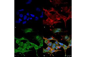 Image no. 1 for anti-Chloride Channel 3 (CLCN3) (AA 98-115) antibody (PE) (ABIN2485485)