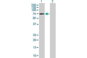 Image no. 1 for anti-Interleukin 18 Receptor 1 (IL18R1) (AA 1-541) antibody (ABIN522253)