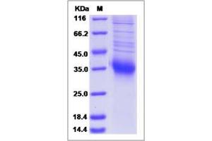 Image no. 1 for Retinoic Acid Early Transcript 1E (RAET1E) (AA 1-225) protein (His tag) (ABIN2006715)