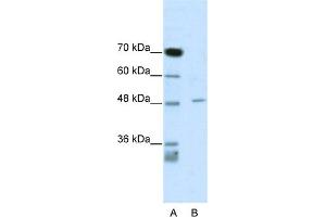 Image no. 1 for anti-Calcium Channel, Voltage-Dependent, beta 4 Subunit (CACNB4) (C-Term) antibody (ABIN2776098)