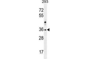 Image no. 2 for anti-NK1 Homeobox 2 (NKX1-2) (AA 53-82), (N-Term) antibody (ABIN953716)