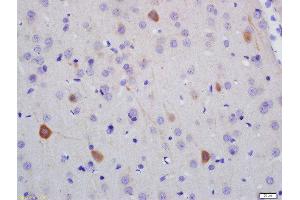 Image no. 2 for anti-Neurofilament, Heavy Polypeptide (NEFH) (AA 21-120) antibody (ABIN2177936)
