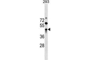 Image no. 1 for anti-Zinc Finger and BTB Domain Containing 32 (ZBTB32) (AA 95-125), (N-Term) antibody (ABIN955627)