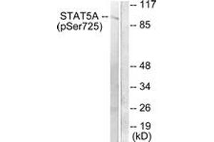 Western blot analysis of extracts from Jurkat cells treated with EGF 200ng/ml 30', using STAT5A/B (Phospho-Ser725/730) Antibody.