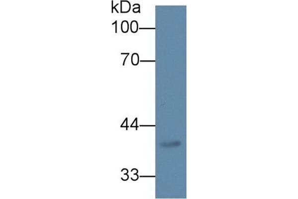 anti-Dipeptidase 2 (DPEP2) (AA 303-486) antibody