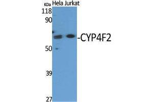 Image no. 1 for anti-Cytochrome P450, Family 4, Subfamily F, Polypeptide 2 (CYP4F2) (N-Term) antibody (ABIN3184201)