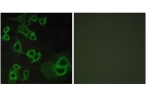Image no. 2 for anti-Adenosine A3 Receptor (ADORA3) (AA 269-318) antibody (ABIN1535560)