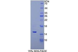 Image no. 1 for Defensin, alpha 5, Paneth Cell-Specific (DEFA5) (AA 20-94) protein (His tag) (ABIN1170303)