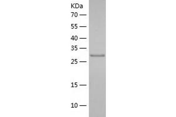 DDI1 Protein (AA 33-326) (His tag)