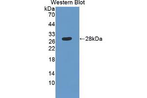 Image no. 1 for anti-SH2B Adaptor Protein 3 (SH2B3) (AA 225-447) antibody (ABIN5013892)