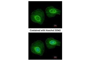 ICC/IF Image Immunofluorescence analysis of methanol-fixed HeLa, using Cytokeratin 34, antibody at 1:200 dilution.