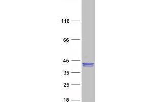 Image no. 1 for Clavesin 1 (CLVS1) protein (Myc-DYKDDDDK Tag) (ABIN2730976)