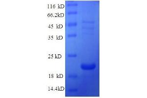 Protein expressed in E.