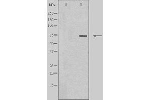 Image no. 2 for anti-Solute Carrier Family 5 (Sodium/glucose Cotransporter), Member 2 (SLC5A2) (N-Term) antibody (ABIN6258324)