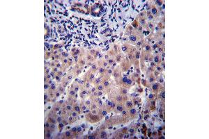 Immunohistochemistry (IHC) image for anti-Cytochrome P450, Family 3, Subfamily A, Polypeptide 4 (CYP3A4) antibody (ABIN2158457)
