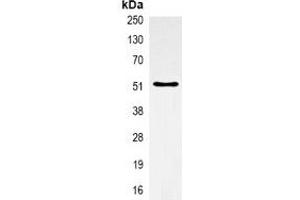 Image no. 3 for anti-alpha Tubulin (TUBA1) antibody (ABIN2852681)