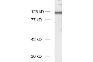 Image no. 1 for anti-NMDA Receptor 1 (NMDA R1) (AA 35-53) antibody (ABIN1742246)