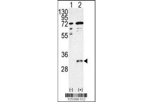 Western Blotting (WB) image for anti-CTD (Carboxy-terminal Domain, RNA Polymerase II, Polypeptide A) Small Phosphatase 1 (CTDSP1) antibody (ABIN2158391)