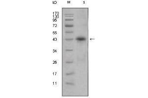 Image no. 1 for anti-Apolipoprotein L, 1 (APOL1) antibody (ABIN968963)