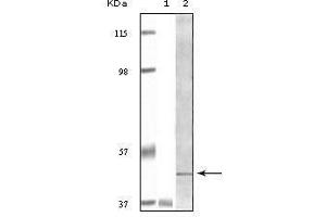 Image no. 2 for anti-B Lymphoid Tyrosine Kinase (BLK) antibody (ABIN968981)
