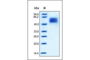 Image no. 1 for Interleukin 13 Receptor, alpha 1 (IL13RA1) (AA 22-343) (Active) protein (His tag) (ABIN2181335)