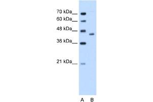 Image no. 1 for anti-Alcohol Dehydrogenase 1B (Class I), beta Polypeptide (ADH1B) (C-Term) antibody (ABIN2776992)